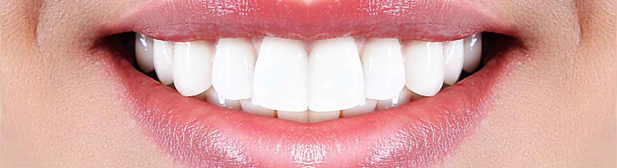 Diş Beyazlatma Tedavisi Bleaching Fiyatları